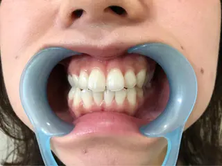 メンズ セルフホワイトニングサロン　ラヴィアン所属・ホワイトニングサロン La vie enのその他イメージ