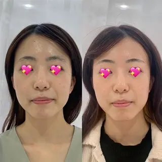 ポーラザビューティー 松原店のエステ・リラクイメージ