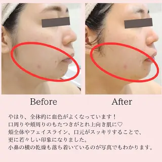 PRETTIEST SHINE所属・山田 浩子のエステ・リラクイメージ