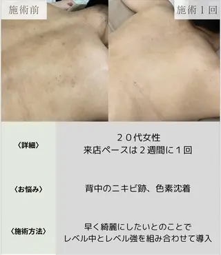 脱毛・眉毛・フェイス サロンN久留米店のその他イメージ