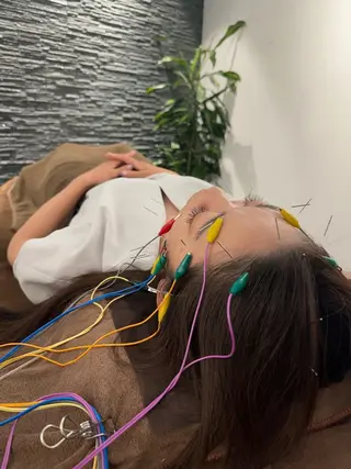 美容鍼灸整体サロンBeauJu所属・小顔矯/美容鍼/鍼灸 BeauJuのその他イメージ