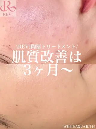 WHITE AQUA 北千住店のエステ・リラクイメージ