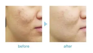 すみれGlow-up Beautyのマツエク・マツパデザイン