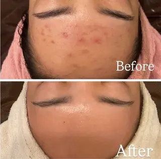 ナルシストータルビューティーサロン所属・友森 千香のエステ・リラクイメージ