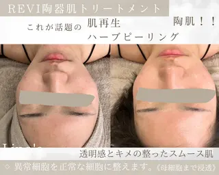 Salon💫 Lino'a柏店のエステ・リラクイメージ