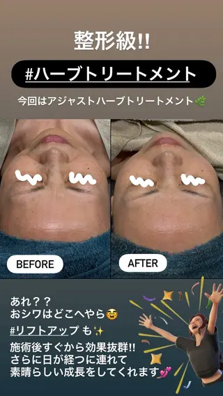 LiZA エステティックサロンのエステ・リラクイメージ
