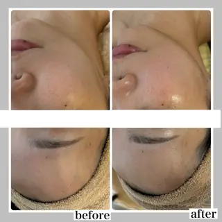 WHITE AQUA 北千住店のエステ・リラクイメージ