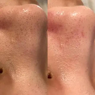 ✨美肌水光✨ アトリエリュバンのエステ・リラクイメージ