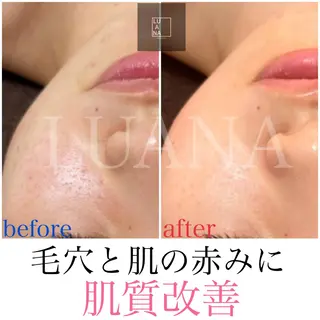 LUANA TAKAGIの眉毛・アイブロウイメージ