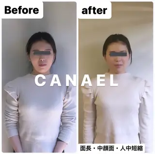 頭蓋骨から小さくする小顔&ヘッドスパ専門店 CANAEL所属・頭蓋骨から小さくする 小顔&ヘッドスパ専門のエステ・リラクイメージ