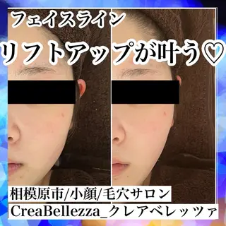 小顔/毛穴サロン クレアベレッツァのエステ・リラクイメージ