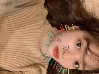 鍼灸整骨院Refine所属・鍼灸 Refineのその他イメージ