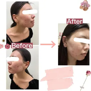 eclat BEAUTY NAIL SALON 楠葉店所属・山田 千智のエステ・リラクイメージ