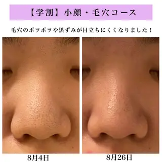 Bellesthe (ベルエステ)のエステ・リラクイメージ