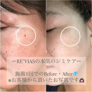 シミケアサロン REVIASオーナーのエステ・リラクイメージ