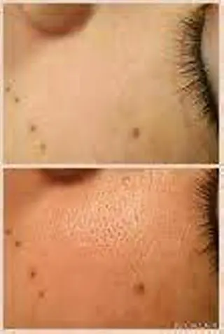 痩身リンパダイエット 隠れ家サロンチャームのエステ・リラクイメージ