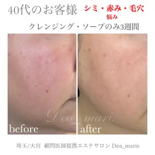 private salon Dea_maris シュガーリング&パーソナルボディケア所属・シミ改善・韓国肌管理 ボディメイク痩身のその他イメージ