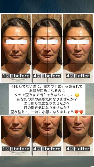 💎後悔させない小顔 矯正💎イトヤマ🌱のエステ・リラクイメージ