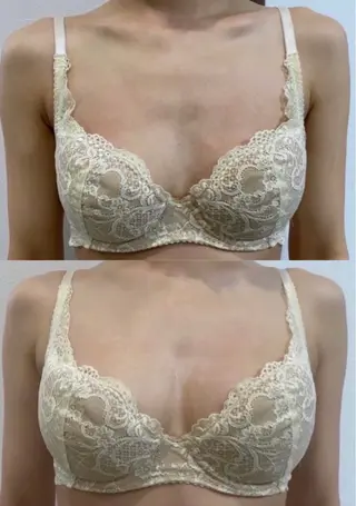 beautysalon RAVIS所属・東大阪/韓国肌管理/ 痩身バスト専門店のエステ・リラクイメージ