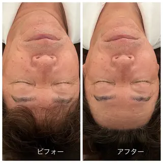 Relaxsalon undo所属・Relaxsalon undoのエステ・リラクイメージ