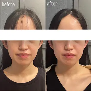 エステサロンino.colore'所属・小顔サロン ino.coloreのエステ・リラクイメージ