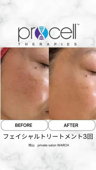 WARCH Marieのその他イメージ