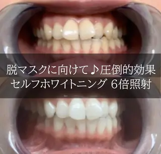 ホワイトニング専門店 LCS 銀座店 峰岡のその他イメージ