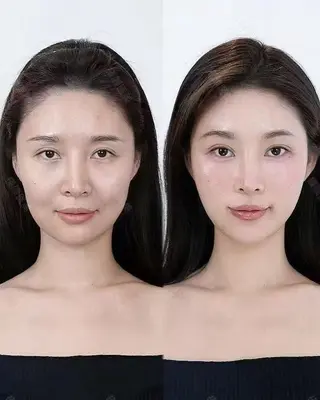 パーマ aliaハイフ&水光ジェットサロン所属・aliaハーブ水光店 エステティシャン募集のエステ・リラクイメージ