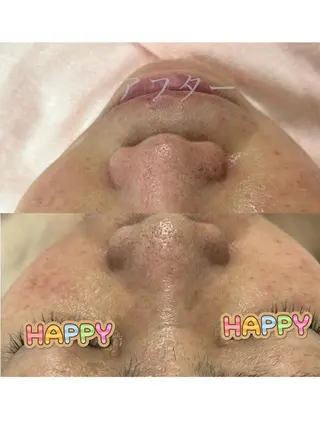 うえつま ふみえのエステ・リラクイメージ