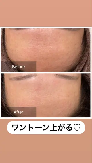 産毛専門店 Bittoのエステ・リラクイメージ