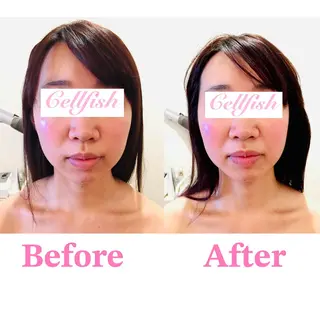 Cellfish ~セルフィッシュ~のエステ・リラクイメージ