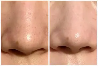 マツエク・マツパ Yamashita 🌙Jessicaのマツエク・マツパデザイン