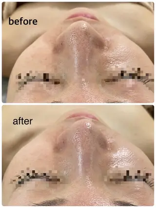 ViMORE あやのネイルデザイン