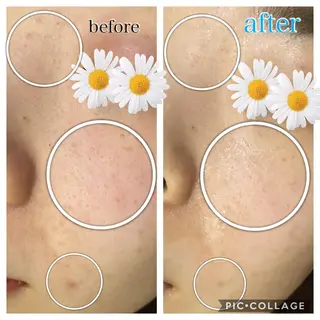 セミロング カラー パーマ ヘアアレンジ キッズ ネイル マツエク・マツパ Ensor Clair所属・EnsorClair 代表 野口真央のエステ・リラクイメージ