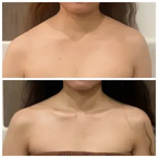 salon ace所属・【小顔矯正】 salonaceのエステ・リラクイメージ