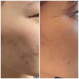 Mignon所属・mignon /栄のエステ・リラクイメージ