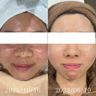 De'Im福井店所属・【福井シェアサロン】 青木優奈のエステ・リラクイメージ