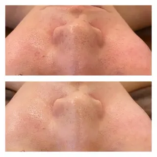 通うほど変わる本格 エステ心斎橋REVIのエステ・リラクイメージ