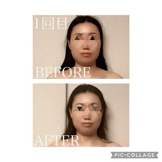 肩こり・腰痛改善専門 1万人以上施術の碧人のエステ・リラクイメージ