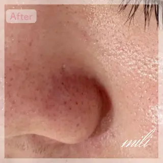 毛穴ケア専門サロン miliのエステ・リラクイメージ