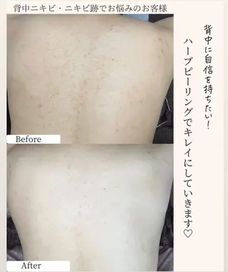 ベラージュ【美背中・ 美尻・フェイシャル】のエステ・リラクイメージ