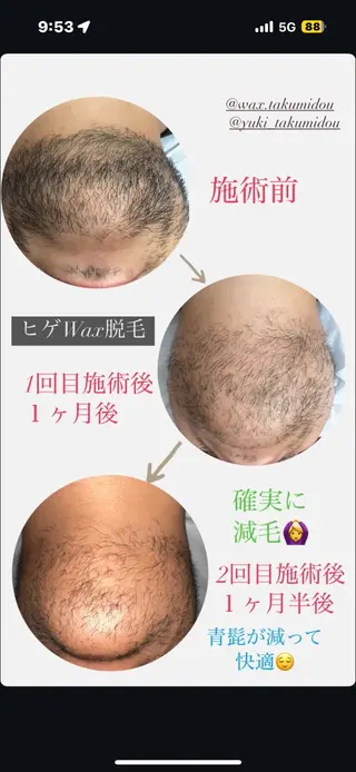 美肌salon reamel（レアメル）所属・TANAKA SAYAKAのエステ・リラクイメージ