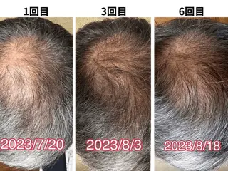 美容とカラダの鍼灸 サロン やなけんのエステ・リラクイメージ