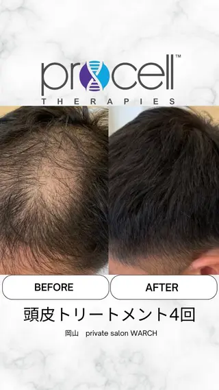 WARCH Marieのその他イメージ