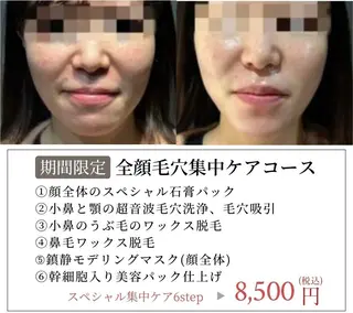 Maple 【美容サロン】の眉毛・アイブロウイメージ