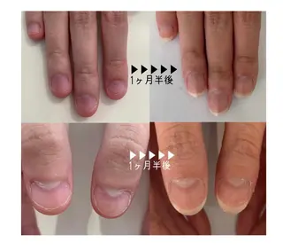 ネイル 毛穴改善/脱毛 ネイル 川上久仁子のエステ・リラクイメージ