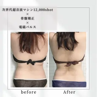 小顔矯正専門店 【RED】池田のエステ・リラクイメージ