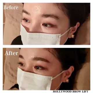 アイブロウ B&H所属・頭痛•肩こり専門/ 眉サロンB&H心斎橋のエステ・リラクイメージ