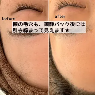 美肌コラーゲン脱毛SINCERITE【サンセリテ】所属・瀬野 のぞみのエステ・リラクイメージ