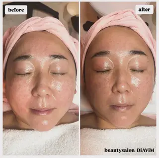 beautysalon  DiAViM所属・本格コルギ美肌美眉 DiAViM 💎のエステ・リラクイメージ